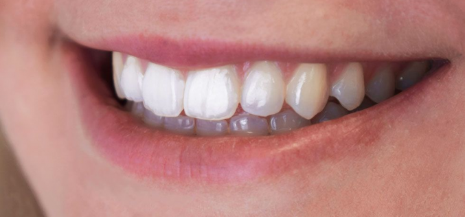 Best Ways Of making Your Teeth Look Whiter in Photos